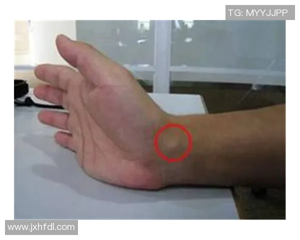 米奇-约翰逊左手腕受伤并不影响回归时间线